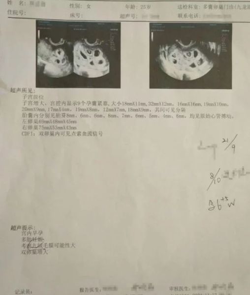 Беременная 9 детьми женщина из Китая потеряла всех малышей, почему это с ней произошло, все подробности