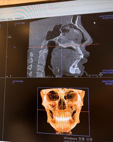 Фан Ціюань з Тайваню Фан Ціюань з Тайваню, пластична операція, рентген в аеропорту, косметичні процедури, зовнішність, краса, фото, курйози