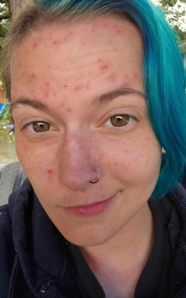 фенікс не в лікарні