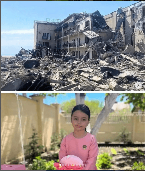 Саша Паскаль, Олександра Паскаль, протезування, дитячий протез, дитина з протезом, ракетний удар по затоці, реабілітація дитини з ампутацією, реабілітація інвалідів, допомога інвалідам, паскаль одеса, паскаль затока, маша паскаль