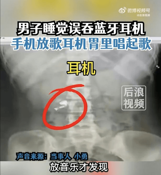 Знімок рентген, навушник, лікарня,