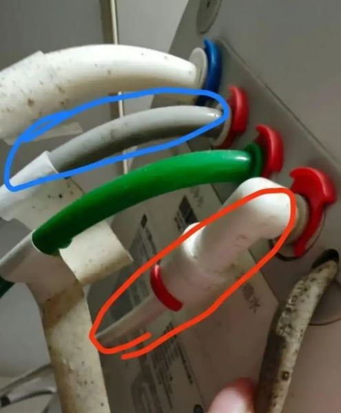 Жінка протягом 5 років пила брудну воду з-під крана, як це вплинуло на її організм та самопочуття