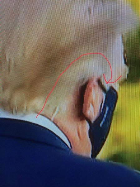 трамп, кислород, ковид