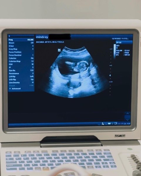 Айрленд Болдвін бойфренд, алек болдвін дочка, алек болдвін дідусь, кім бейсінгер