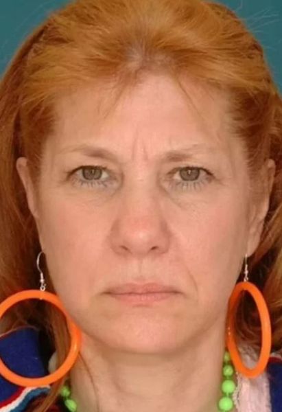 Однояйцевые близняшки, как изменилась их внешность, учитывая различные перипетии судьбы, интересный эксперимент