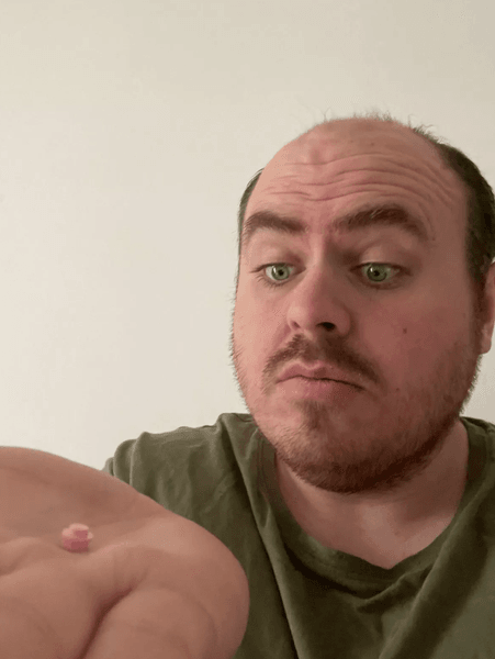 Мужчина прожил 20 лет с деталью от конструктора в ухе, что он чувствовал, интересные истории, странные случаи из жизни