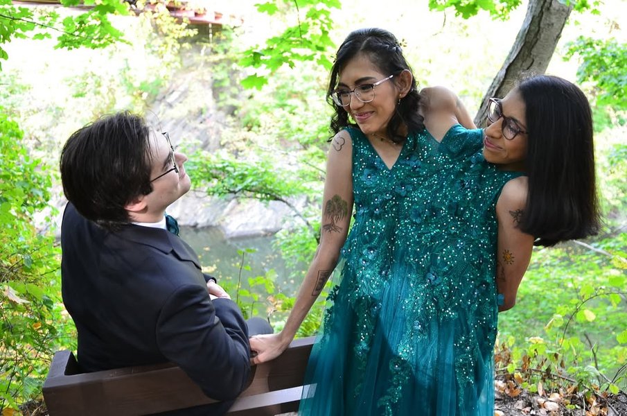 Сіамські близнючки любов