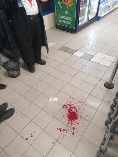 Пострадавшему разбили нос, была кровь