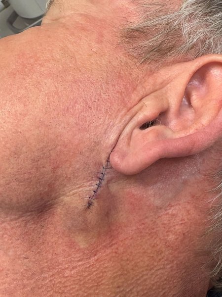 Гордон Рамзи лечится