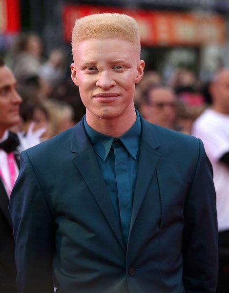 Шон Росс, Shaun Ross, модель з альбінізмом, чоловік-модель-альбінос