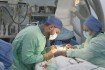 кардиохирургия, сердечный клапан, операция на сердце
