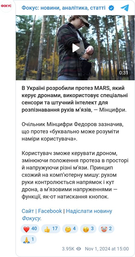 Випробування протеза від Esper Bionics Esper Bionics